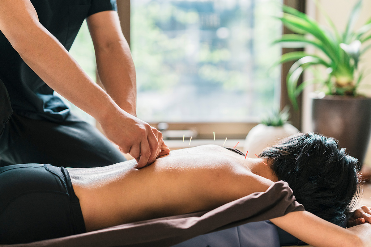 Therapist Giving Acupuncture Treatment To Young Woman