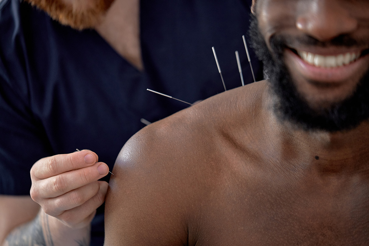 Acupuncture therapy on back and shoulders for increased mobility after surgery.