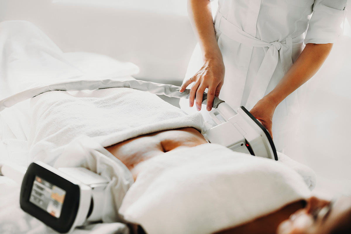 Close up photo of a cryolipolysis fat treatment procedure